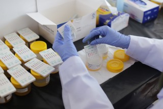 UPNVJ Terapkan Tes Kesehatan untuk Camaba SNBP 2026, Cek Alur dan Biayanya